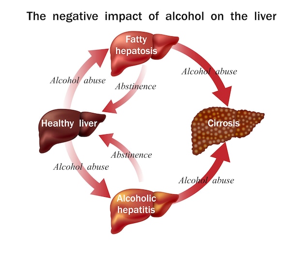 A detailed infographic illustrating the two phases of liver detoxification: Phase I, showing enzymes modifying toxins, and Phase II, showing conjugation of toxins for excretion.